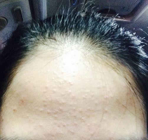  [自知]脸上有这几个征兆，就表示真的要好好护肤了，很多人都不自知！