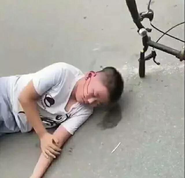 松原朋友圈疯传前郭三中孩子被车撞啦!假的!