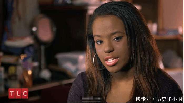 她患白斑症躲粉底下7年，当决心卸妆后，网友惊呼美呆了！