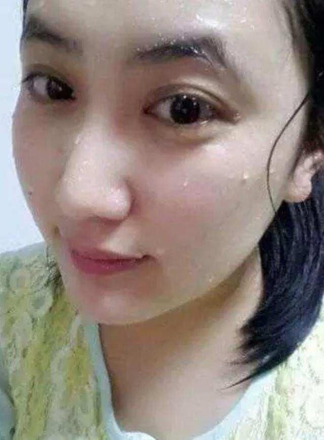 脸上成螨虫窝，痘痘会疯长，不必去医院，教你3招快速灭螨祛痘