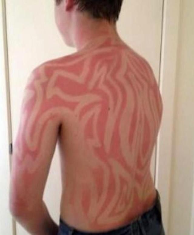 英国100年来最热夏天？别再去晒日光浴了！