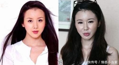 当然,也有很多女星还是整容成功的