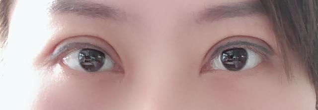  【识破】割的双眼皮会被“一秒识破”吗？最怕空气突然安静！