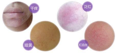 每个女人都希望青春永驻