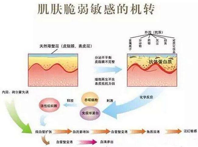  『油敏肌』干货满满，XDG带你一分钟看完油敏肌护理知识