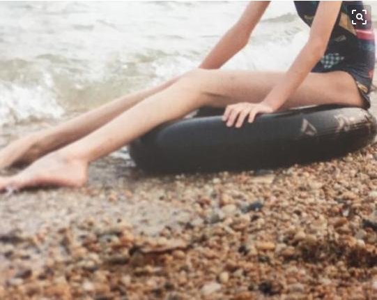 女孩拥有一双大长腿，却不能像平常女孩一样!