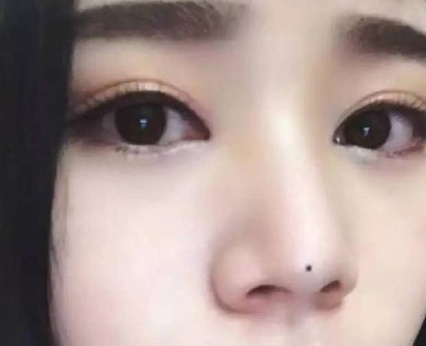 一双眼睛毁掉整张脸，这几种眼睛做双眼皮美爆了，有你没有？