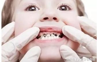 这些关于牙齿问题的谣言，你信以为真了吗？