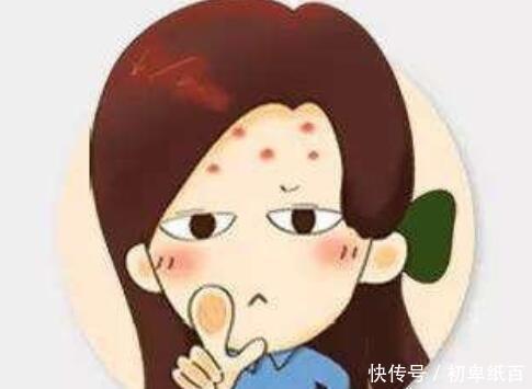  因素■痘印找上你，不止与抠挤有关，还有3个重要因素时常被忽略