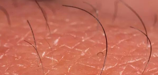 感觉脏脏的!身上搓下来的＂泥＂是何物?