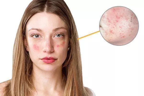 敏感肌和干皮有了这些东西，秋天简直不要太水润! | 好物推荐