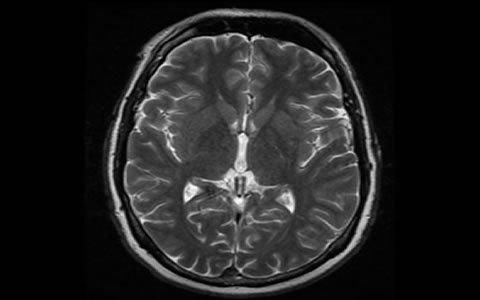 一孕傻三年居然被科学证实了！这个黑锅妈妈们不背？