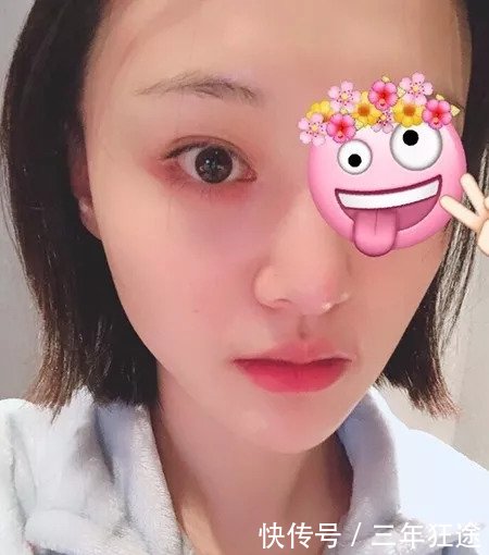 90后郑爽的黑眼圈比周迅都严重？眼部保养要重视了！