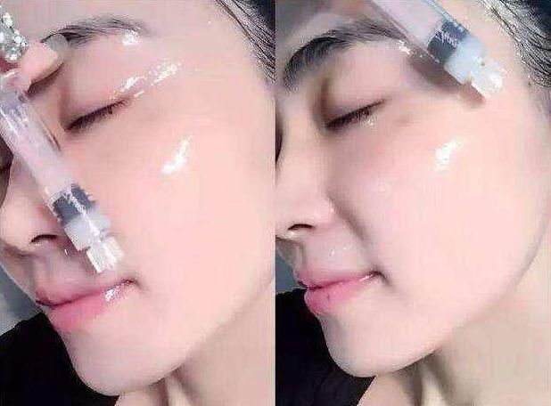 「天天」抗皱精华天天涂,皱纹反而增多了?美容师:或许是你忽视了这3点