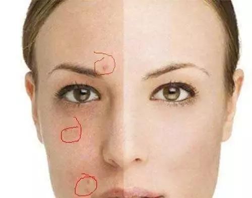 脸上没有螨虫的3大迹象，看看你占了几个?