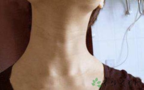 去除颈纹的按摩手法