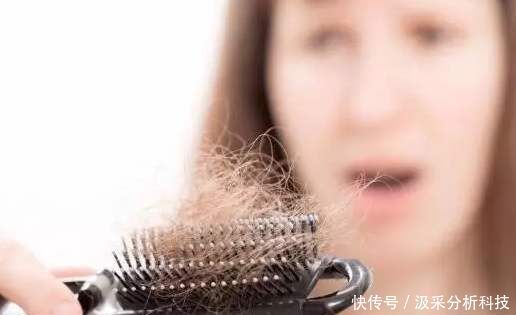  『有用吗』头发干枯分叉去丝域有用吗？