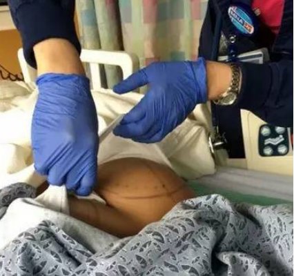 男子痴迷整容,斥巨资在身上动刀,最大的改变居然是臀部!