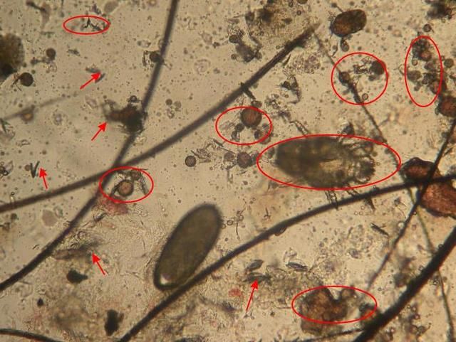 螨虫折腾你的脸有4个损害，不除螨，再多护肤品都是在喂养螨虫