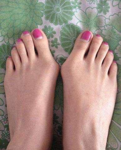 高跟鞋穿多了，身体会出现“三大变化”，快了解一下吧！