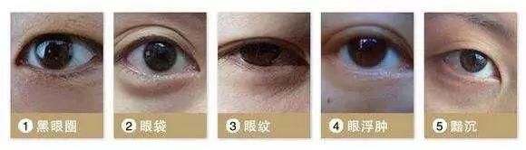 每个女人都希望青春永驻