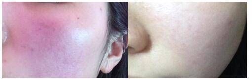 50岁依然可以美得像少女，和王菲一样拥有年轻理想新肌