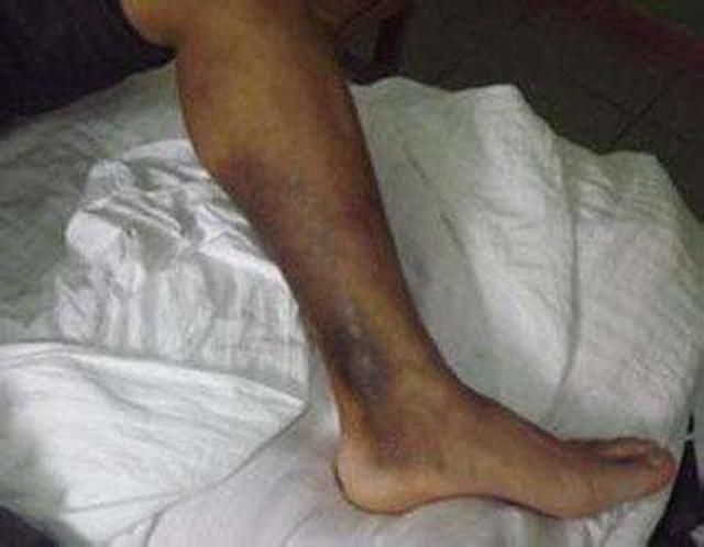 厉害了我的哥，女子画了条“牛仔裤”出门了