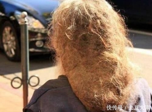  发质■头发多久洗一次最健康？医生：大于“这个数”，难怪头发越洗越少