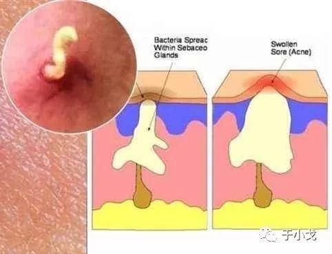 什么切乳房,烤肉,脂肪瘤,女明星写才是谣言重地