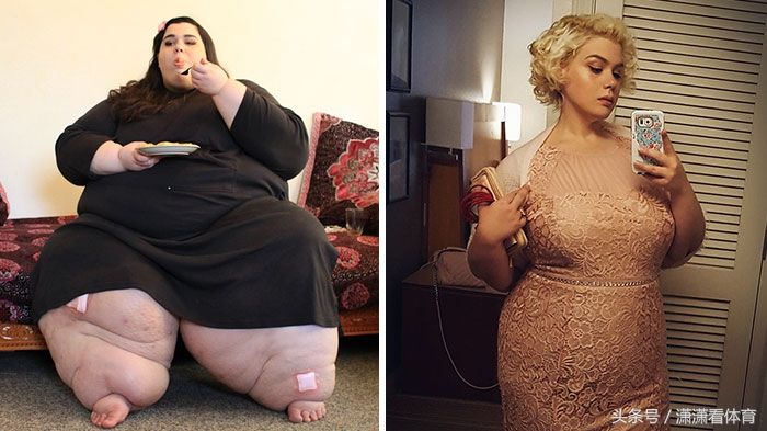 这群体重超过500斤的人仍回归正常,减肥堪比整容!