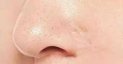 当男神准备亲我时，因为看到它们而逃跑了！