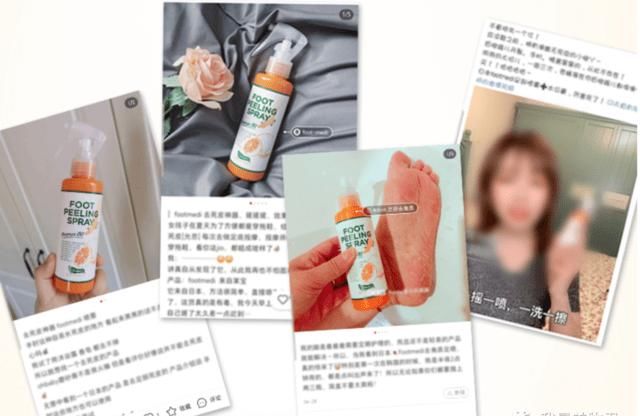 「jio」拯救脚后跟|凉鞋季马上来了,你的jio部护理开始做了吗?