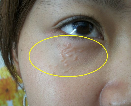 48岁小姨子泄密:药店一便宜药膏，没事抹一抹，眼袋、细纹全消