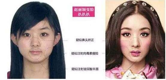 请来烂片之王当新经纪人之后，赵丽颖再遭前经纪人撕胯，猛料更多