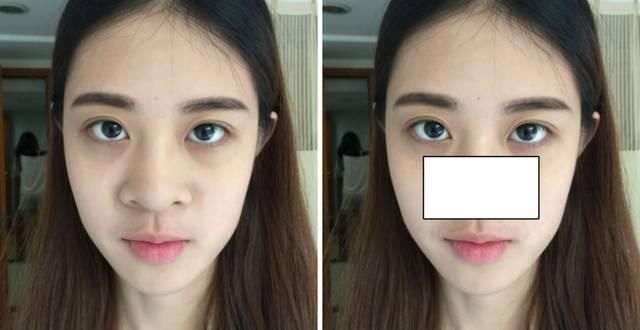  「看起来就」为什么做了整形也没有变好看