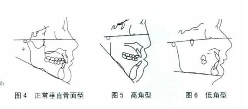  【内收】【骨相】下颌骨之美，决定你的脸型关键点