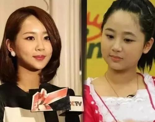 杨紫胖了瘦、瘦了胖无限循环，张一山对她的减肥史总结的很到位！
