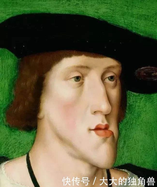 臀部连在一起的双胞胎,被卖到马戏团,还生了个