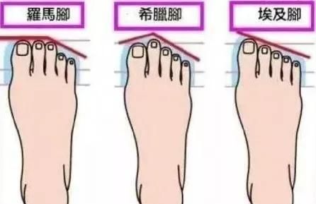 「罗马脚」女人脚型有三种,第一种穿凉鞋超好看,你是属于哪一种呢?
