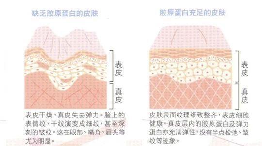  黑色素■激光美白真的有用么？上周我去亲身体验了一次