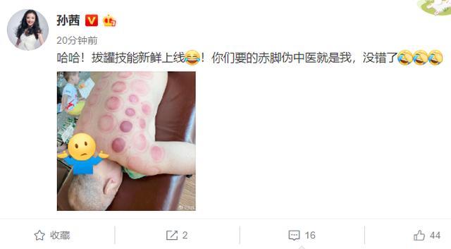 「上线」孝顺女上线!孙茜为家人拔火罐,老父亲后背全是淤青看着就疼