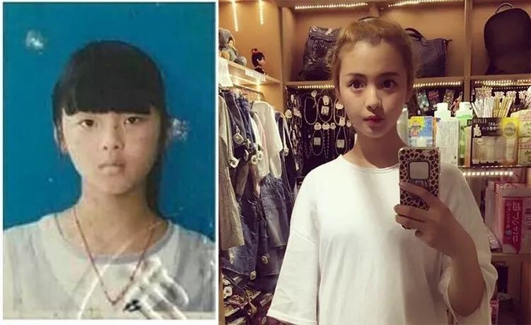 转发杨超越就能心想事成?别迷信了先瘦瘦脸吧