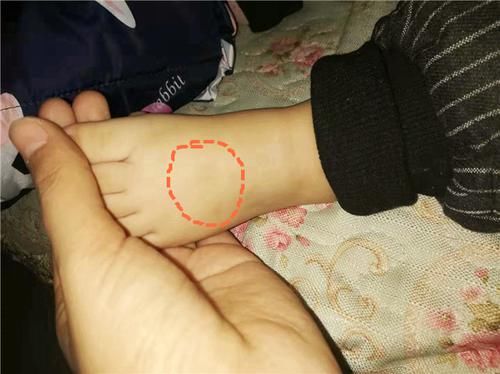 合适■如何为孩子挑选合适的鞋子,是漂亮还是实用,起火的鞋子不要买