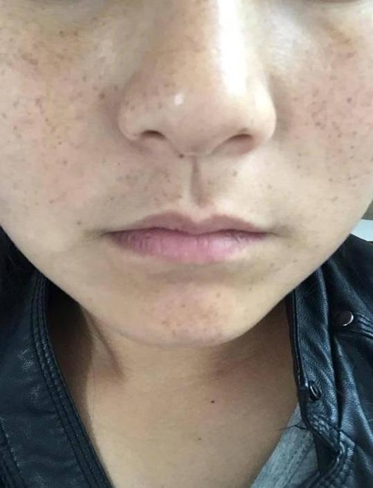 小小的它加上蜂蜜,祛斑仅需一夜间,皮肤嫩白像剥了皮的熟鸡蛋