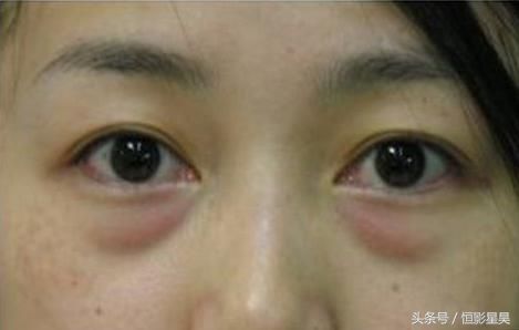 晚上睡觉前用它擦脸，久了就会发现皱纹眼袋居然消失了