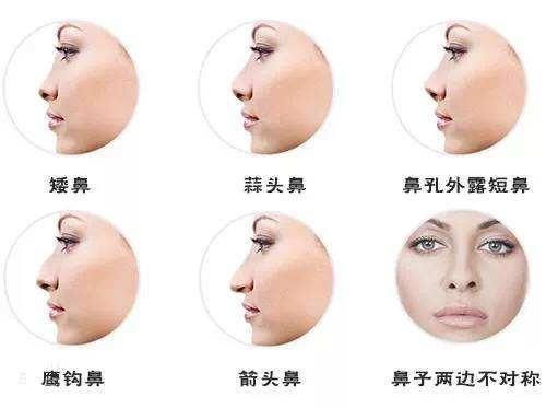  【好看】鼻子不好看，怎么做女神？