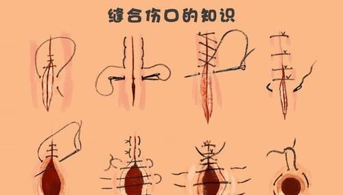  「袭击者」9个可在关键时刻救命的小技巧