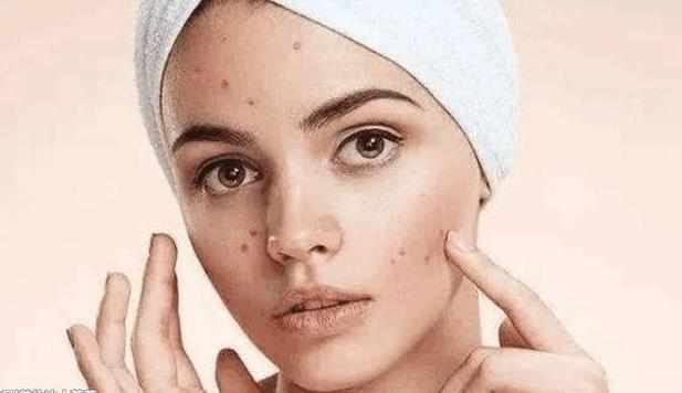 螨虫号称“皮肤田鼠”，脸上到底有没有，对照4道螨虫题一侧便知