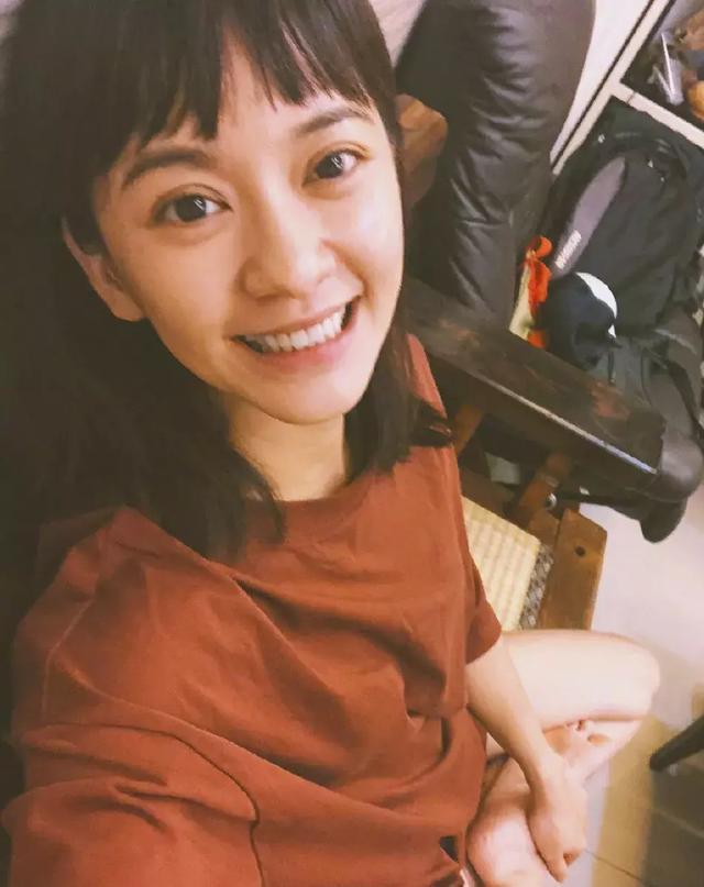  血管型黑眼圈@当妈后黑眼圈明显加重？黑眼圈不是病，挂在眼睛上真“要命”