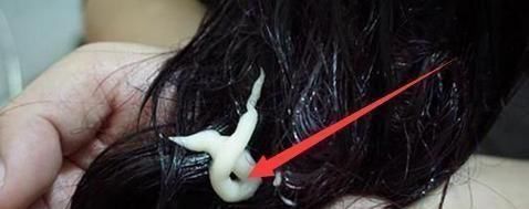  掉发：头发刚打湿就抹洗发水？头发油腻掉发多，教你洗头的正确方式